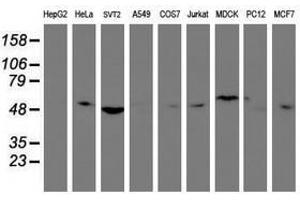 Image no. 2 for anti-Tubby Like Protein 3 (TULP3) antibody (ABIN1501586) (TULP3 antibody)