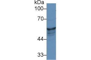 Western Blot; Sample: Human A431 cell lysate; Primary Ab: 1µg/ml Rabbit Anti-Rat KRT8 Antibody Second Ab: 0. (KRT8 antibody  (AA 260-398))