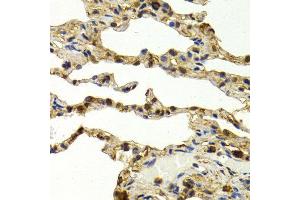 Immunohistochemistry (IHC) image for anti-Sulfotransferase Family, Cytosolic, 1A, Phenol-Preferring, Member 1 (SULT1A1) (AA 1-295) antibody (ABIN3022214) (SULT1A1 antibody  (AA 1-295))
