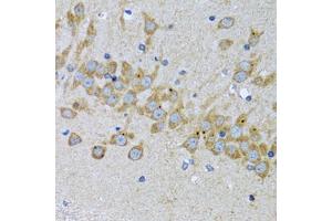 Immunohistochemistry of paraffin-embedded mouse brain using EIF2AK4 antibody. (GCN2 antibody)