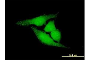 Immunofluorescence of purified MaxPab antibody to LOC81691 on HeLa cell. (LOC81691 antibody  (AA 1-774))