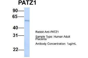 Host:  Rabbit  Target Name:  PATZ1  Sample Type:  Human Adult Placenta  Antibody Dilution:  1. (PATZ1 antibody  (N-Term))