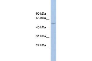 WB Suggested Anti-ANKRD13D Antibody Titration: 0. (ANKRD13D antibody  (Middle Region))