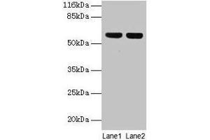 Western blot All lanes: ATP5F1A antibody at 2 μg/mL Lane 1: Hela whole cell lysate Lane 2: COLO205 whole cell lysate Secondary Goat polyclonal to rabbit IgG at 1/10000 dilution Predicted band size: 60, 55, 58 kDa Observed band size: 60 kDa (ATP5F1A (AA 44-553) antibody)