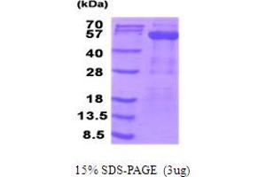SDS-PAGE (SDS) image for Pyruvate Dehydrogenase Complex, Component X (PDHX) (AA 54-501) protein (His tag) (ABIN6387533)