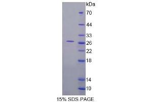 SDS-PAGE (SDS) image for 3-Ketodihydrosphingosine Reductase (KDSR) (AA 64-271) protein (His tag) (ABIN4989291)