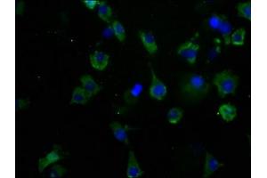 Immunofluorescence staining of SH-SY5Y cells with ABIN7175604 at 1:50, counter-stained with DAPI. (CACNA1B antibody  (AA 2132-2339))