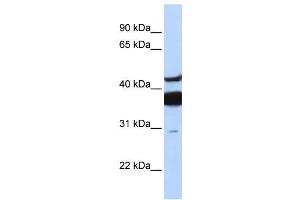 Western Blotting (WB) image for anti-Ceramide Synthase 2 (CERS2) antibody (ABIN2457964) (Ceramide Synthase 2 antibody)