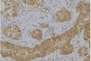 ABIN6273644 at 1/100 staining Human uterus tissue by IHC-P. (IFNA2 antibody  (N-Term))