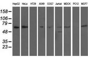 Western blot analysis of extracts (35 µg) from 9 different cell lines by using anti-AFP monoclonal antibody. (alpha Fetoprotein antibody)