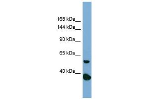 Host:  Rabbit  Target Name:  RAD50  Sample Type:  PANC1 Whole Cell lysates  Antibody Dilution:  1. (RAD50 antibody  (N-Term))
