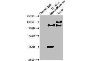 Immunoprecipitating Phospho-RB1 in Hela whole cell lysate Lane 1: Rabbit control IgG(1 μg)instead of ABIN7127740 in Hela whole cell lysate. (Recombinant Retinoblastoma 1 antibody  (pSer780))