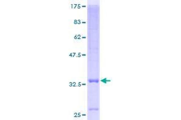 SLC39A3 Protein (AA 1-105) (GST tag)