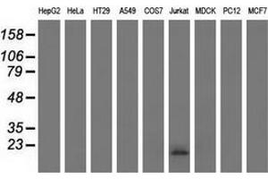 Western blot analysis of extracts (35 µg) from 9 different cell lines by using anti-EFNA2 monoclonal antibody. (Ephrin A2 antibody)