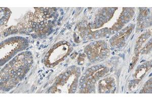 ABIN6277635 at 1/100 staining Human prostate tissue by IHC-P. (PNMT antibody  (N-Term))