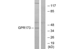 Western Blotting (WB) image for anti-G Protein-Coupled Receptor 173 (GPR173) (Internal Region) antibody (ABIN1853010) (GPR173 antibody  (Internal Region))