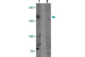 Western blot analysis of PHLPP2 in SW480 cell lysate with PHLPP2 polyclonal antibody  at 1 ug/mL in (1) the presence and (2) the absence of blocking peptide. (PHLPP2 antibody  (C-Term))