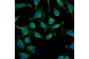 Immunofluorescent analysis of EGFR staining in Hela cells.