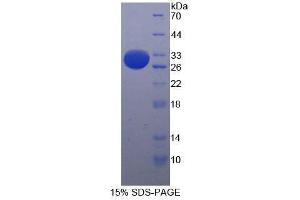 SDS-PAGE analysis of Mouse Integrin alpha E Protein.