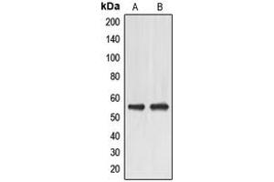 Western blot analysis of EMR4 expression in HeLa (A), HuvEc (B) whole cell lysates.