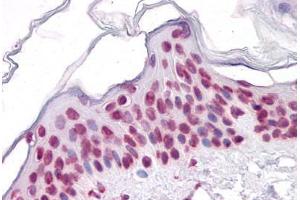 Human Skin: Formalin-Fixed, Paraffin-Embedded (FFPE) (SIRT1 antibody  (AA 456-555))