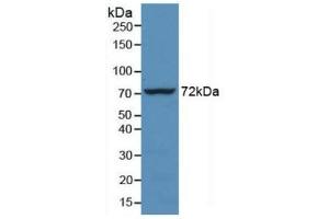 Detection of Recombinant HSPA1L, Human using Monoclonal Antibody to Heat Shock 70 kDa Protein 1 Like Protein (HSPA1L) (HSPA1L antibody  (AA 1-641))