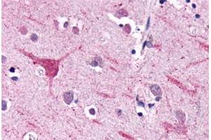 Immunohistochemical (Formalin/PFA-fixed paraffin-embedded sections) staining in human brain, neurons and glia with NPFFR2 polyclonal antibody . (NPFFR2 antibody  (3rd Extracellular Domain))