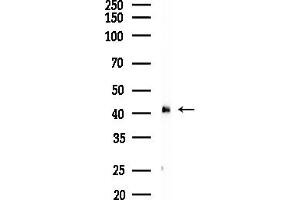 anti-Hydroxy-delta-5-Steroid Dehydrogenase, 3 beta- and Steroid delta-Isomerase 2 (HSD3B2) (Internal Region) antibody
