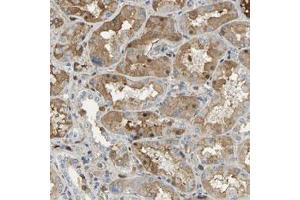Immunohistochemical staining (Formalin-fixed paraffin-embedded sections) of human kidney with GYG2 polyclonal antibody  shows moderate cytoplasmic and nuclear positivity in cells in tubules. (Glycogenin 2 antibody)