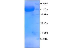 MYBPC2 Protein (AA 739-1141, partial) (His tag)