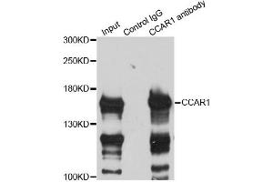 Immunoprecipitation analysis of 200ug extracts of HeLa cells using 3ug CCAR1 antibody (ABIN6291285).