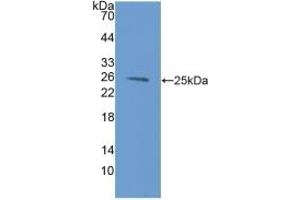 Detection of Recombinant LMP2, Mouse using Polyclonal Antibody to Proteasome subunit beta type-9 (PSMB9) (PSMB9 antibody  (AA 22-219))