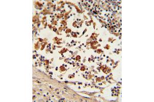 Formalin-fixed and paraffin-embedded human lymph tissue with Bcl-6 Antibody (C-term), which was peroxidase-conjugated to the secondary antibody, followed by DAB staining. (BCL6 antibody  (C-Term))