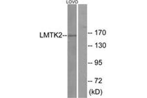 Western blot analysis of extracts from LOVO cells, using LMTK2 Antibody.