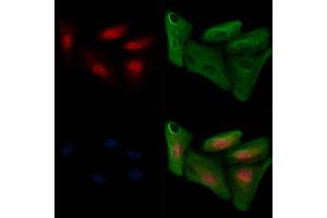 ABIN6255286 and ABIN6267647 staining  cells(H2O2 treatment) by IF/ICC.
