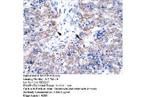 Human Liver (HIV-1 Tat Interactive Protein 2, 30kDa (HTATIP2) (N-Term) antibody)