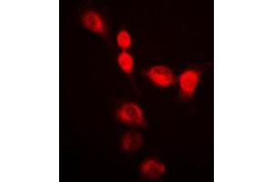 Immunofluorescent analysis of SMUG1 staining in HeLa cells. (SMUG1 antibody  (Center))