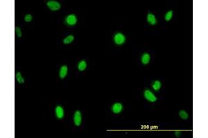 Image no. 1 for anti-N-Methylpurine-DNA Glycosylase (MPG) (AA 1-90) antibody (ABIN598819) (MPG antibody  (AA 1-90))