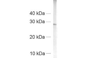 dilution: 1 : 1000, sample: crude synaptosomal fraction of rat brain (P2) (Synaptogyrin 1 antibody  (AA 170-234))