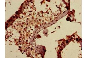 Immunohistochemistry of paraffin-embedded human testis tissue using ABIN7144358 at dilution of 1:100 (AP1S3 antibody  (AA 1-104) (Biotin))