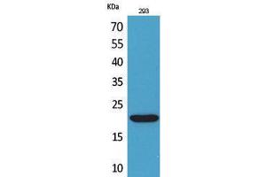 Western Blotting (WB) image for anti-CKLF-Like MARVEL Transmembrane Domain Containing 6 (CMTM6) (C-Term) antibody (ABIN3178338)