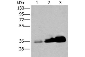 Western blot analysis of Human testis tissue NIH/3T3 and 231 cell lysates using UBE2Z Polyclonal Antibody at dilution of 1:350 (UBE2Z antibody)