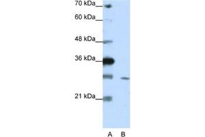 Western Blotting (WB) image for anti-Zinc Finger Protein 397 (ZNF397) antibody (ABIN2461947)