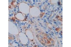 Used in DAB staining on fromalin fixed paraffin- embedded skin tissue (Annexin A9 antibody  (AA 1-345))