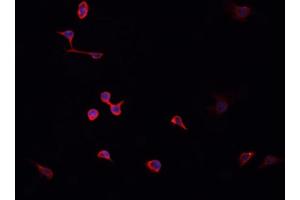 ABIN6268820 staining HeLa cells by IF/ICC. (HNRNPA2B1 antibody  (N-Term))