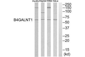 Western blot analysis of extracts from HeLa cells, K562 cells, HepG2 cells and HuvEC cells, using B4GALNT1 antibody. (B4GALNT1 antibody  (Internal Region))