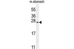 Western Blotting (WB) image for anti-Dynein, Cytoplasmic 2, Heavy Chain 1 (DYNC2H1) antibody (ABIN3002490)