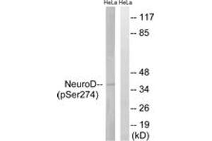 Western blot analysis of extracts from HeLa cells treated with UV 15', using Neuro D (Phospho-Ser274) Antibody. (NEUROD1 antibody  (pSer274))