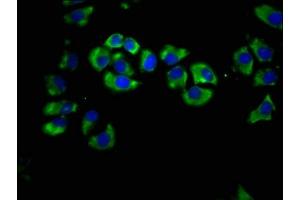 Immunofluorescence staining of A549 cells with ABIN7158410 at 1:66, counter-stained with DAPI. (LIPH antibody  (AA 175-325))