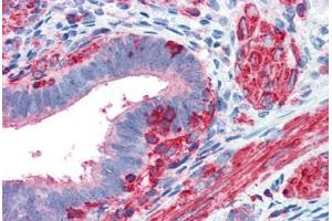Human Uterus (formalin-fixed, paraffin-embedded) stained with ACTB antibody ABIN337261 at 5 ug/ml followed by biotinylated goat anti-rabbit IgG secondary antibody ABIN481713, alkaline phosphatase-streptavidin and chromogen. (beta Actin antibody  (N-Term))